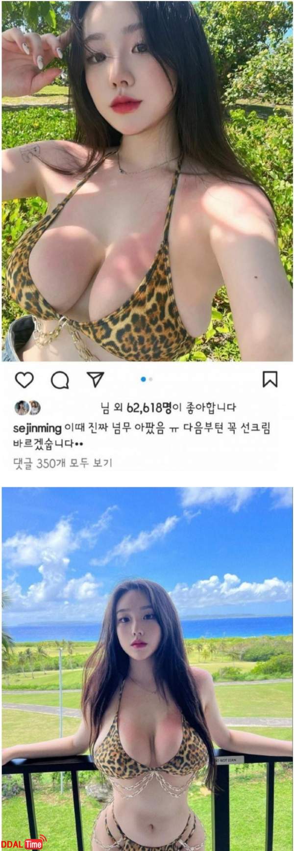 기무세딘 선크림 안바른 결과 이미지 #1