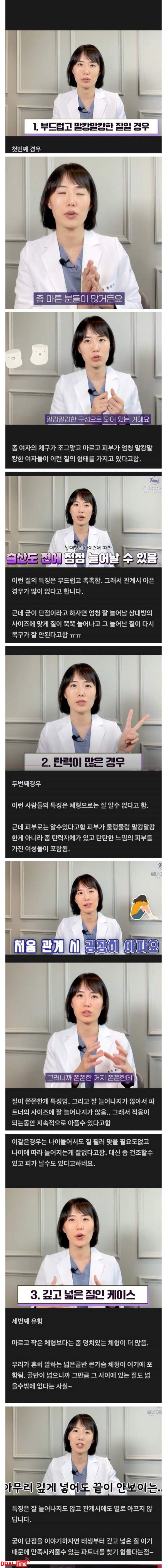 산부의과 의사가 말하는 여자 질타입 이미지 #1